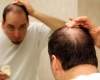 Natural ways to prevent hair fall!