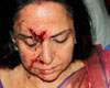 Hema-Malini--accident