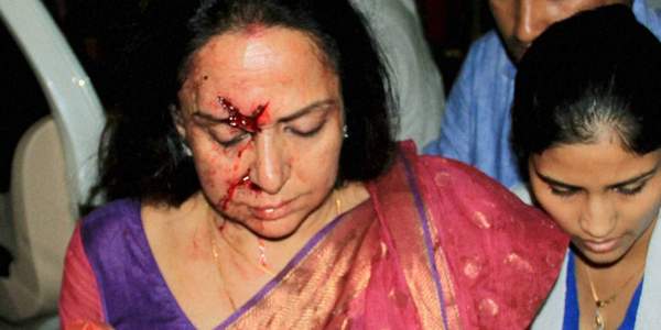Hema-Malini--accident