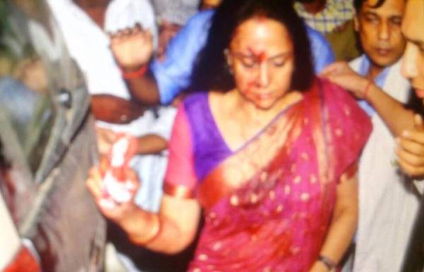 Hema Malini injured in car accident