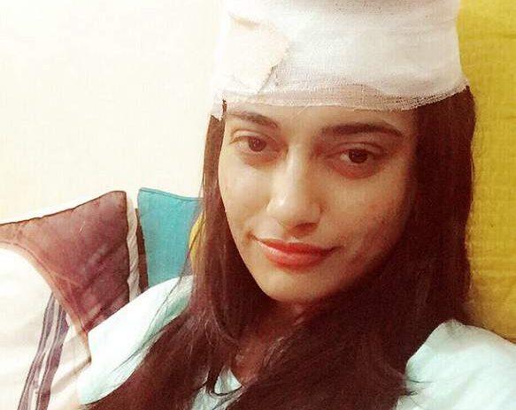 bollywood actress surabhi jyothi head injured