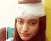 Bollywood actress' head injured badly