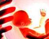 Surrogacy ban hits Hyderabad hard