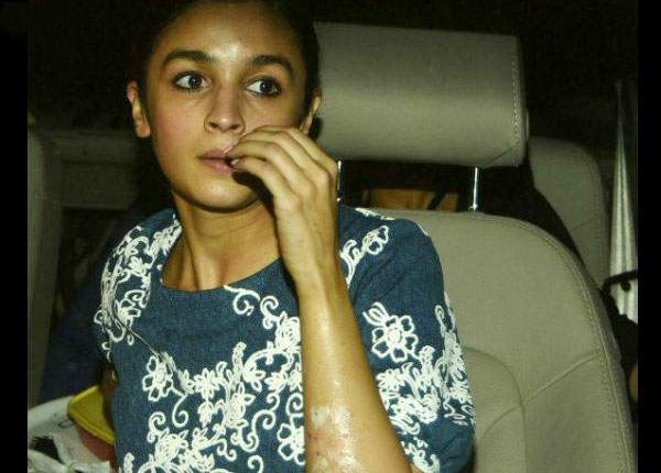 alia bhatt face and hands burned in award function