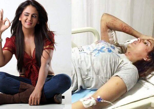 Parul Yadav Attacked by Stray Dogs; Out of Danger Now!