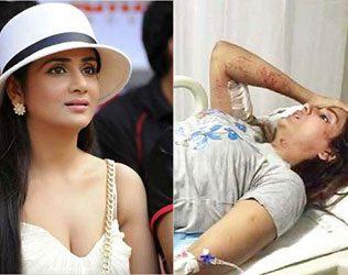 parul yadav biten by street dogs