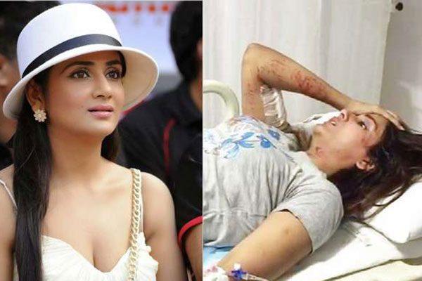 parul yadav biten by street dogs