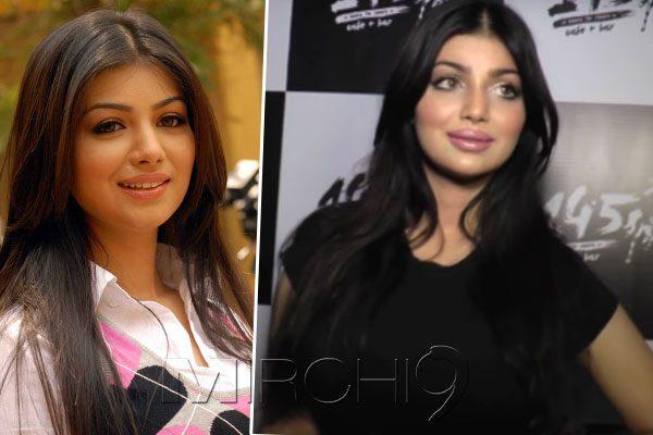 Plastic Surgery Goes Wrong for Ayesha Takia