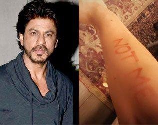 Shah Rukh Khan Has Another Shoulder Surgery