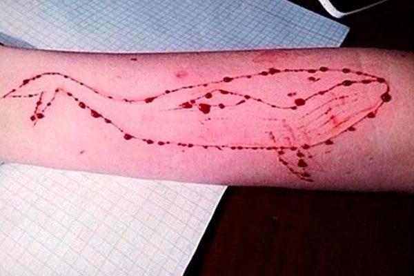 Blue Whale’ suicide game linked to 130 teen deaths
