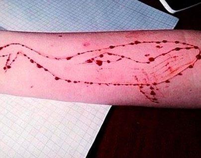 Blue Whale’ suicide game linked to 130 teen deaths