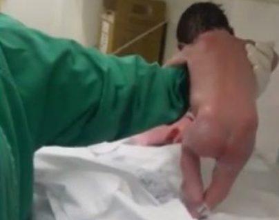 Newborn-Walks-in-Minutes-After-Birth