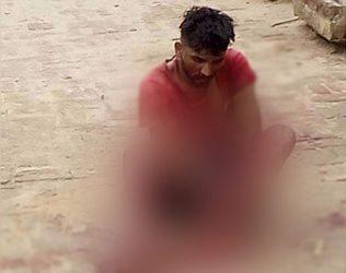 Man Brutally Chopped off Limbs by Punjab Villagers Dies