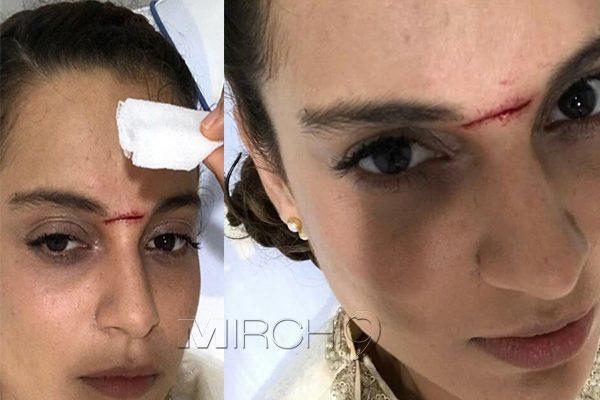 Krish Forced To Cancel Shoot 