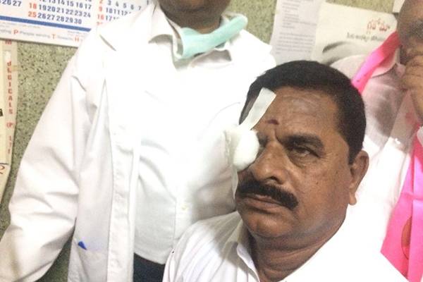 Telangana Legislative council chairman Swamy Goud suffer injuries