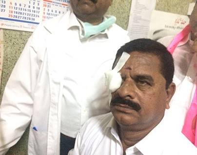 Telangana Legislative council chairman Swamy Goud suffer injuries
