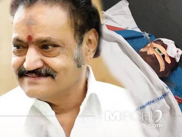 Nandamuri Harikrishna -Road Accident