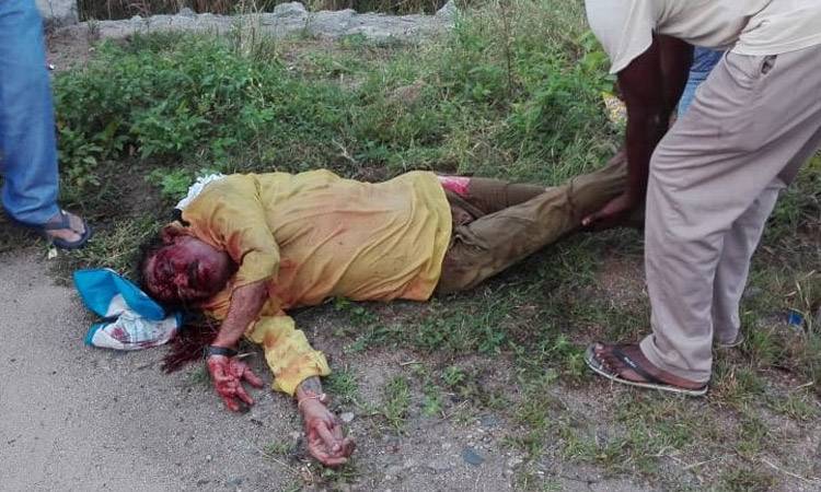 Nandamuri Harikrishna Serious Road Accident