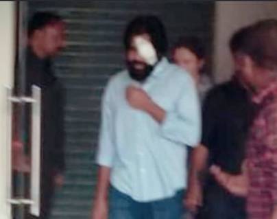 Pawan Kalyan's Eye Surgery Pic in Circulation