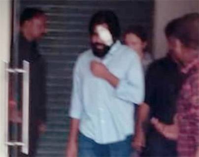 #PawanKalyan Undergone eye surgery