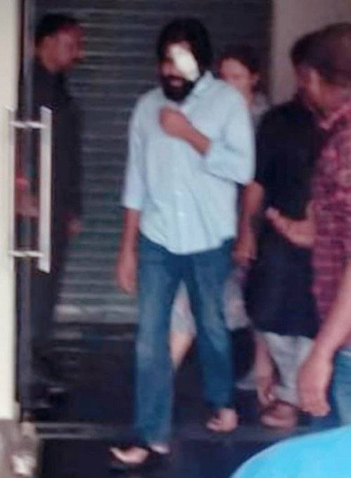 #PawanKalyan Undergone eye surgery