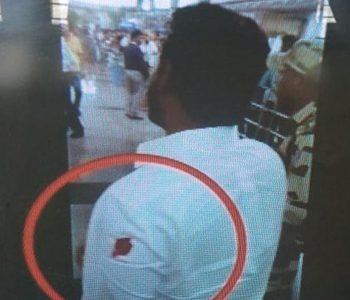 Contrasting Doctor Reports Creates More Doubts about Jagan's Case