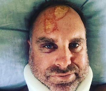 Matthew Hayden spinal injuries while surfing in Queensland