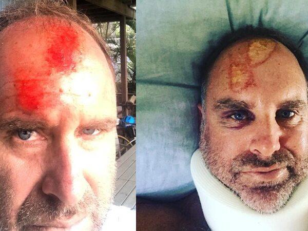 Matthew Hayden spinal injuries while surfing in Queensland