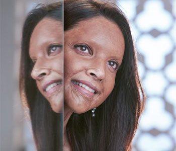 Deepika Padukone -Chhapaak