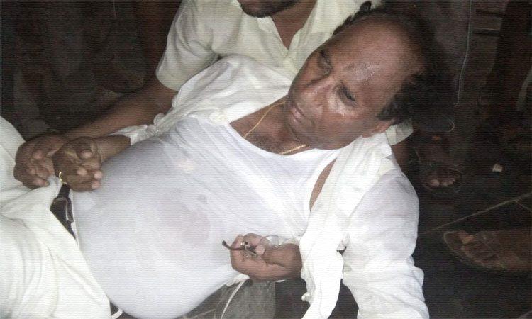 Attack on Kodela Siva Prasad