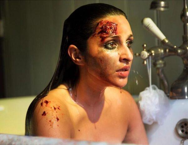 Parineeti-Chopra,-Scared-Actress'-Stunning-Bruised-Look
