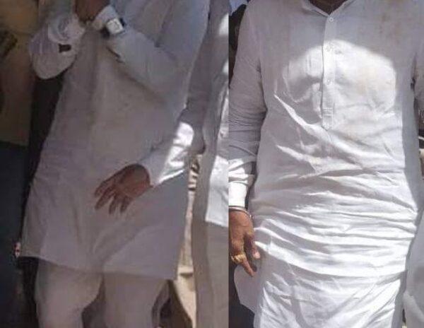First Time Visible Change in Balakrishna