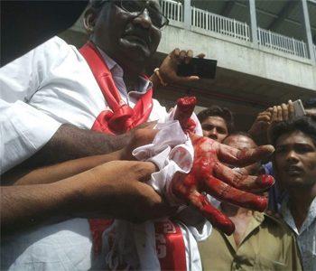 CPI ML Potu Ranga Rao Thumb Cut Off During Protest