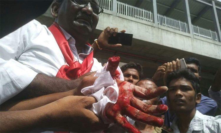 CPI ML Potu Ranga Rao Thumb Cut Off During Protest