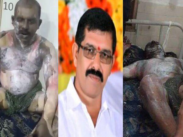 TSRTC Driver Srinivas Reddy Died