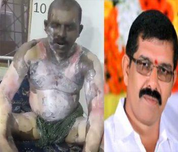 TSRTC Driver Srinivas Reddy Died