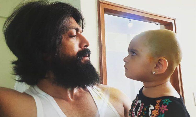 Yash's Beard Removal Video Was a Mistake 