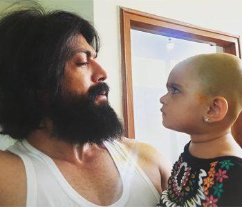 Yash's Beard Removal Video Was a Mistake