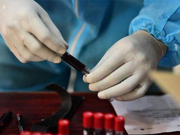 Corona-Vaccine,-Not-As-Easy-As-We-Think