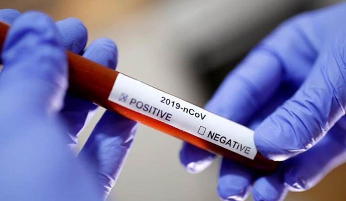 First MLA To Be Infected by Corona in Andhra Pradesh