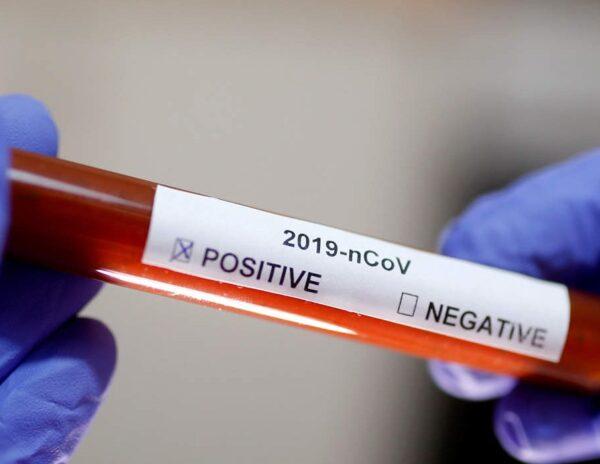coronavirus positive