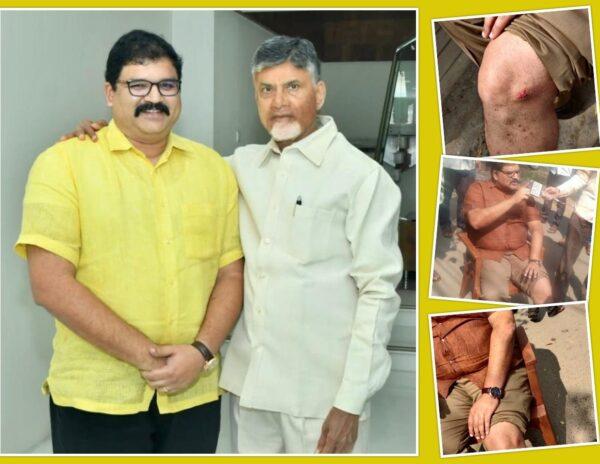 Ruling Party Trying To Scare TDP Away from Panchayat Elections