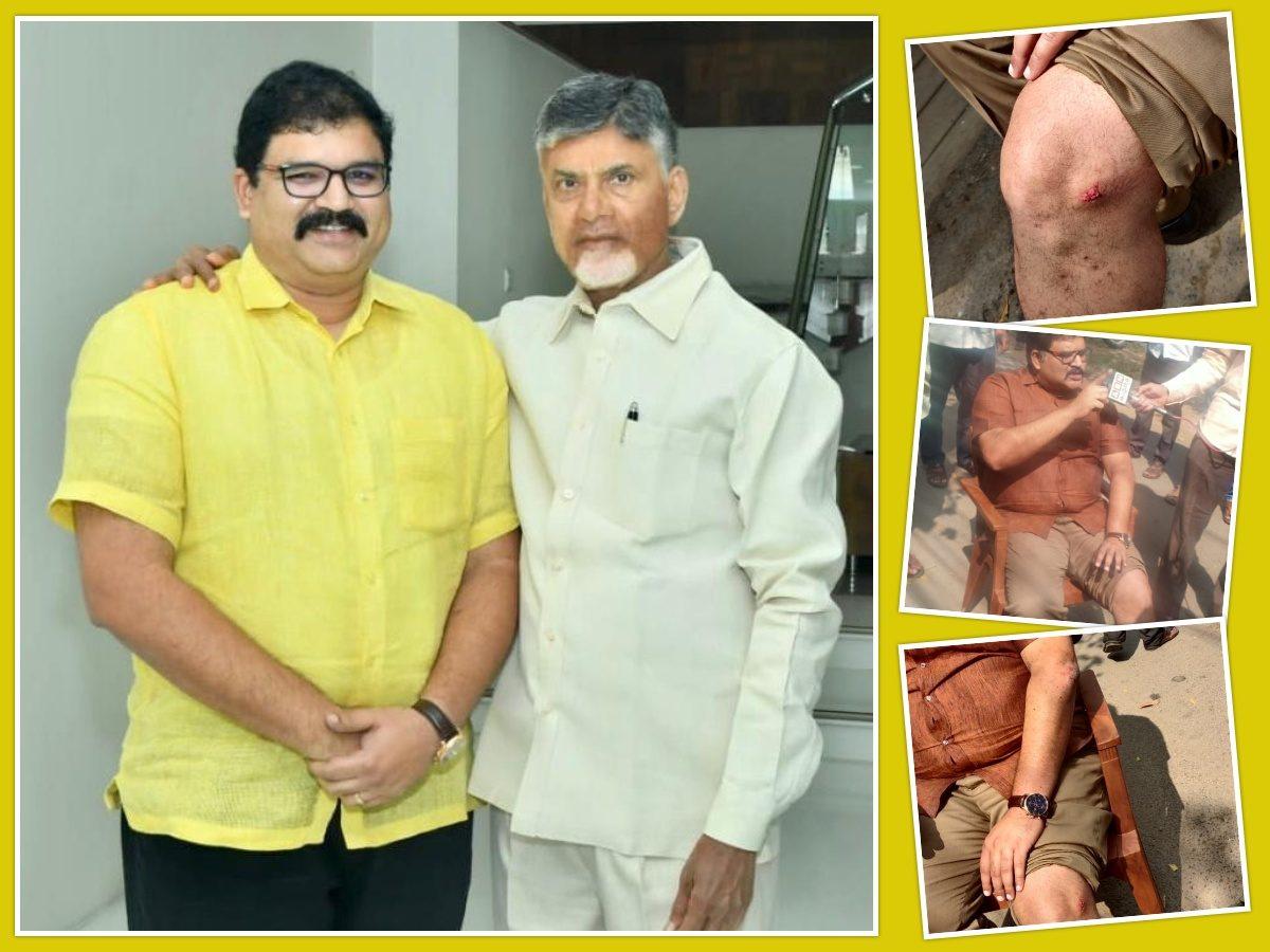 Ruling Party Trying To Scare TDP Away from Panchayat Elections?