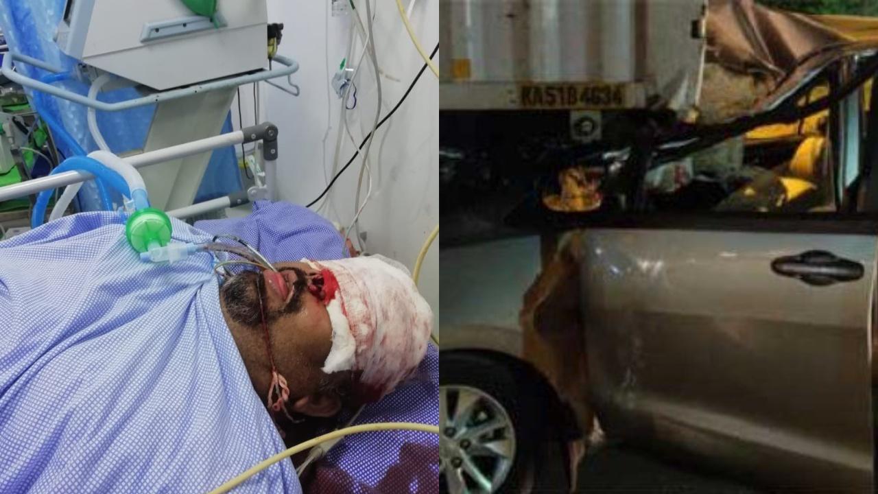 Severely Injured Kathi Mahesh On Ventilator