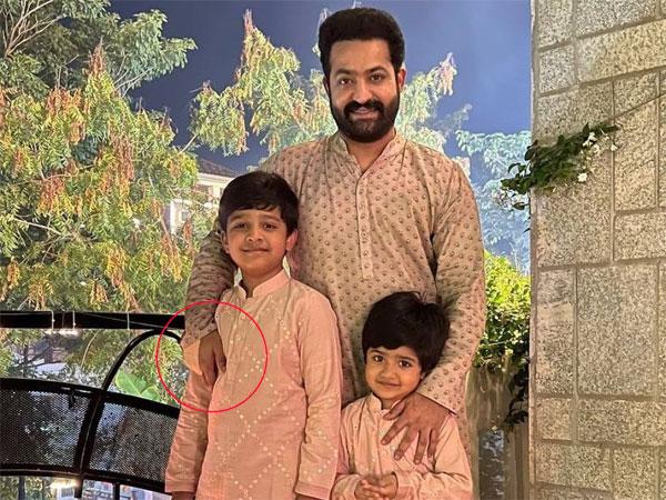 NTR Hurts Himself, Surgery Performed