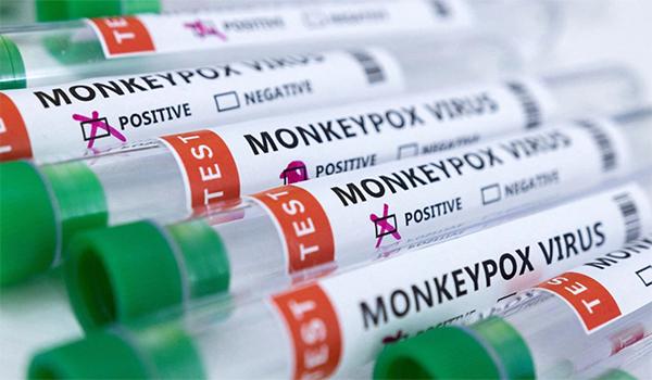 First Monkeypox Case Registered In Vijayawada?