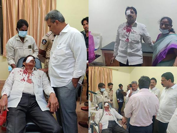 YSRCP-Leaders-Attack-On-TDP-Leader-Chennupati-Gandhi-inVijayawada