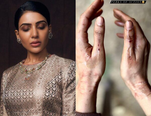 Samantha_Injured