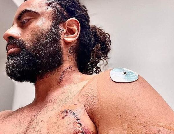 Punjabi Actor Aman Dhaliwal Attacked