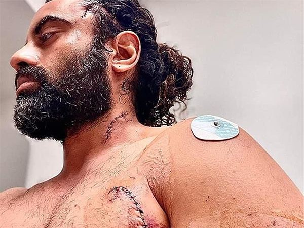 Punjabi Actor Aman Dhaliwal Attacked